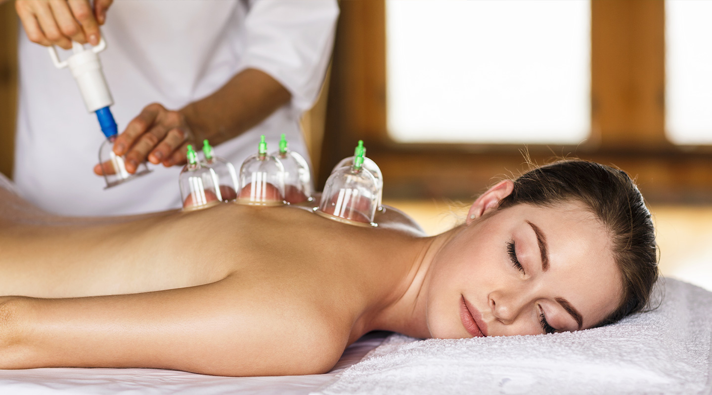 Cupping